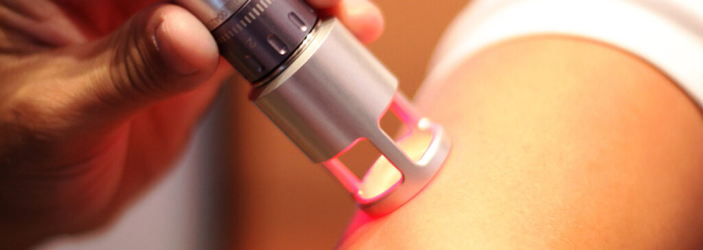 Laser ad Alta Potenza (HILT)