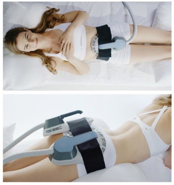 HIFEM (rimodellamento glutei/addome/braccia/cosce)