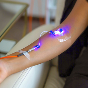 Laser Endovena